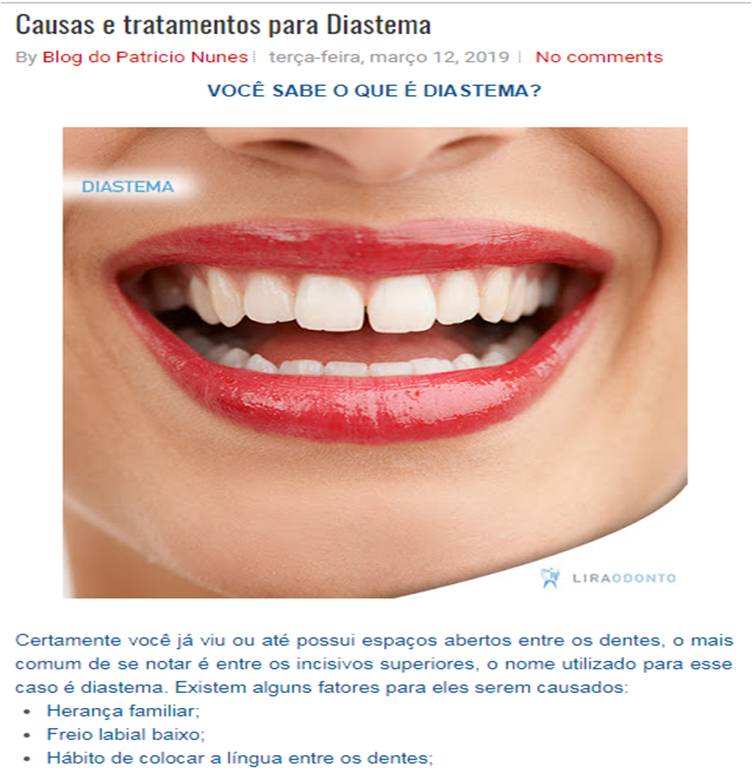 O que é diastema