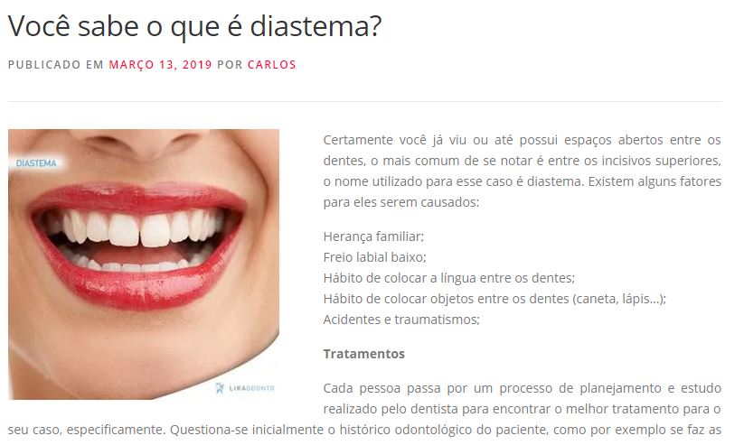 Você sabe o que é diastema? Confira as causas e tratamentos