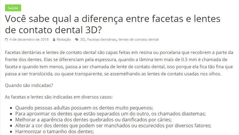 Faceta ou lente de contato dental